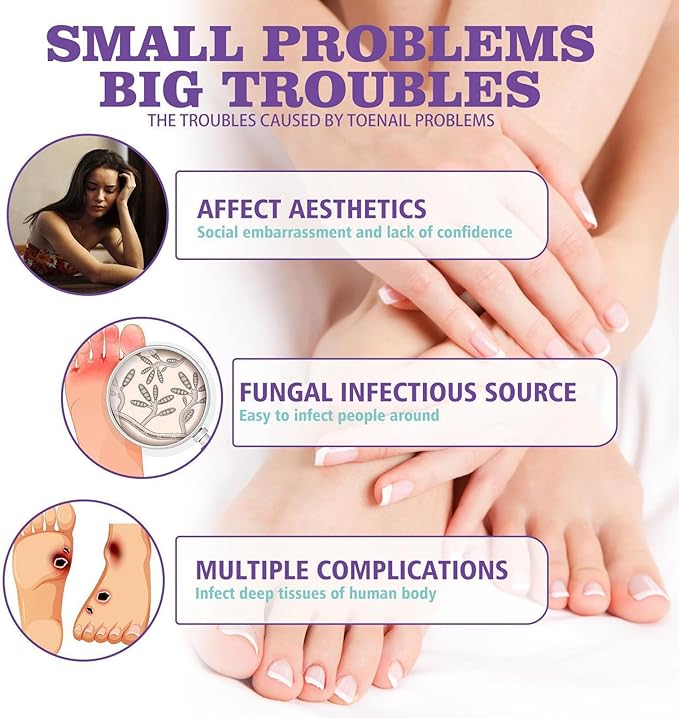 Nail Fungus Spray
