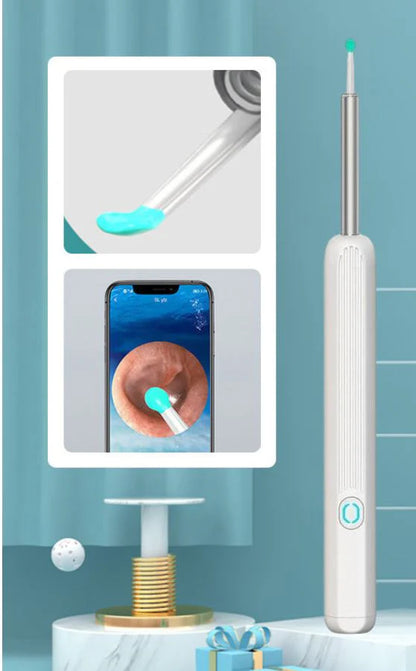 Earwax Removal Kit – Smart Visual Earwax Removal Tool 👂📱